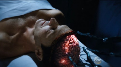 Agents of SHIELD - Coulson being resurrected